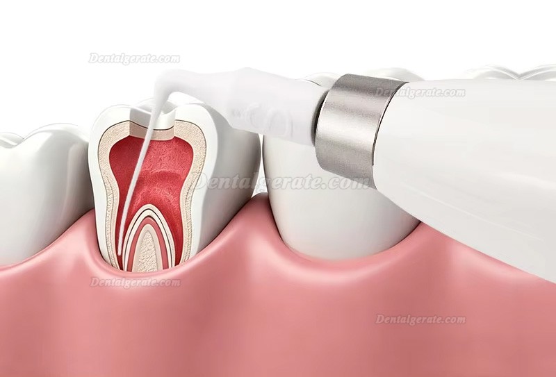 Dental Ultraschall-Endoactivator mit 20 autoklavierbaren Spitzen